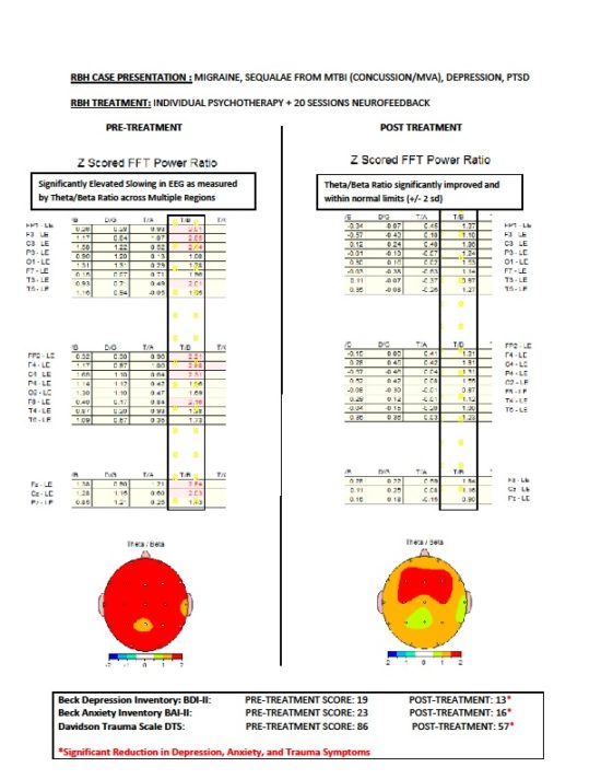 RBH CASE PRESENTATION -PRE-POST QEEG COMPARISON