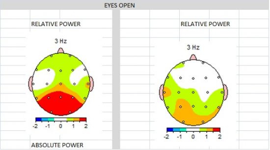 RELATIVE POWER IMPROVEMENT